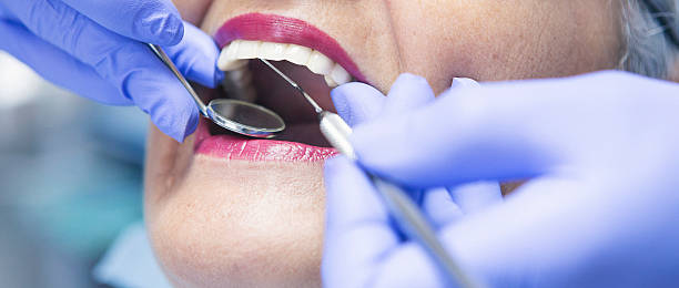 Best Emergency Treatment for Oral Infections in Los Osos, CA